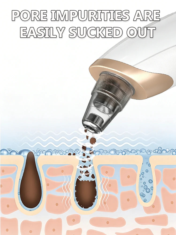 Appareil de nettoyage de peau facial pour l'élimination des points noirs et des boutons, aspirateur de pores pour un nettoyage en profondeur à domicile