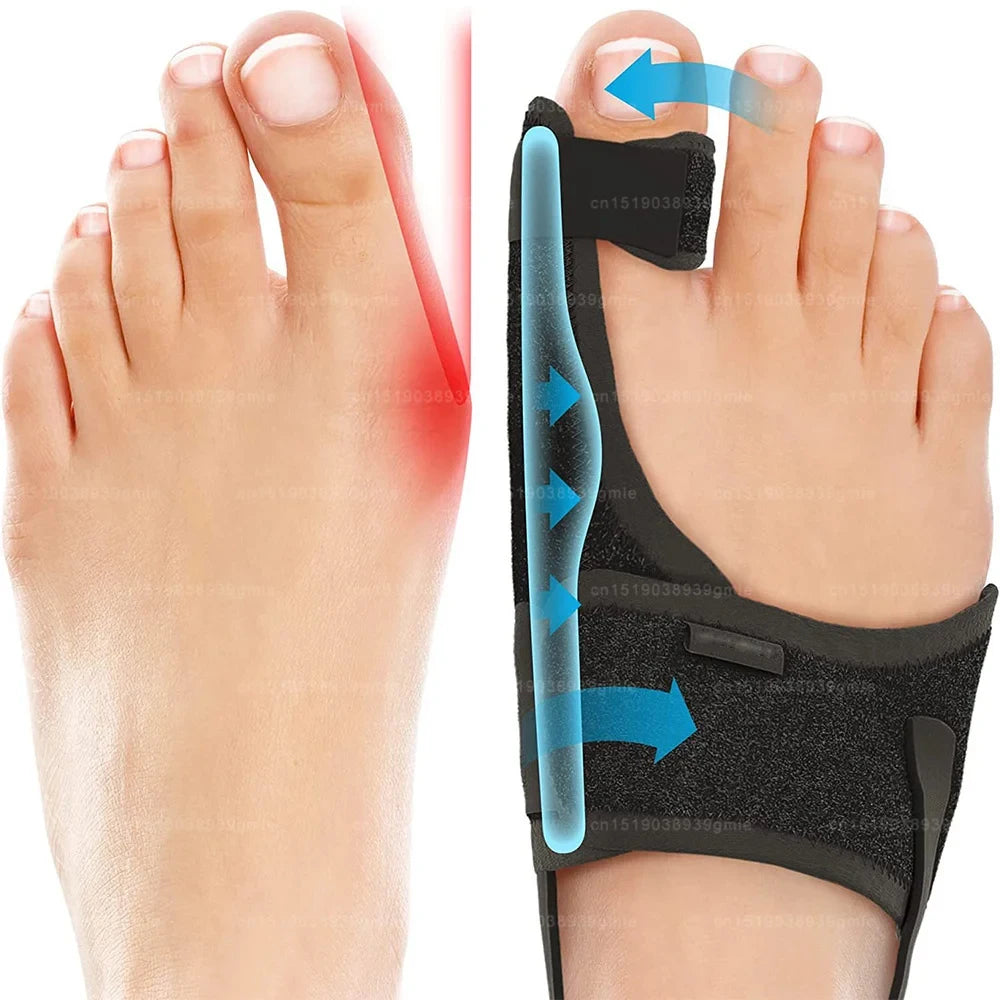 Correcteur d'oignon attelle de nuit pour hallux valgus, redresseur d'orteils, correcteur orthopédique pour pédicure, protecteur d'oignon