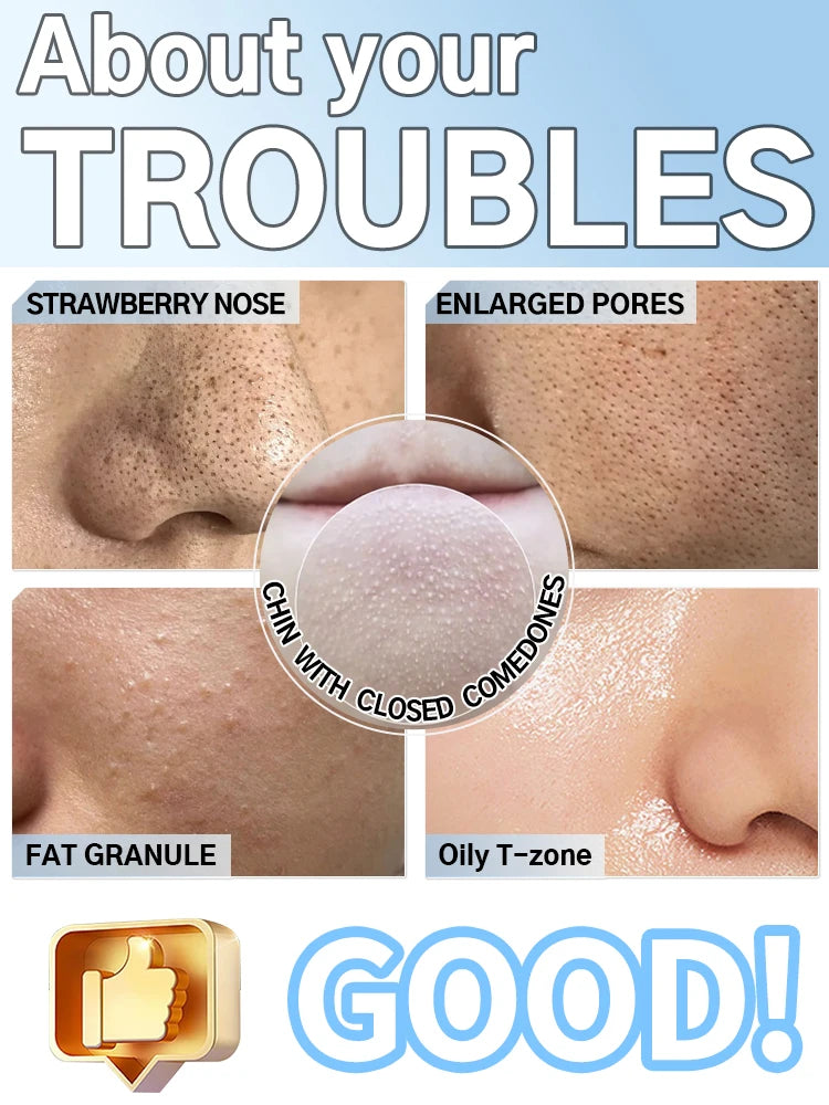 Appareil de nettoyage de peau facial pour l'élimination des points noirs et des boutons, aspirateur de pores pour un nettoyage en profondeur à domicile