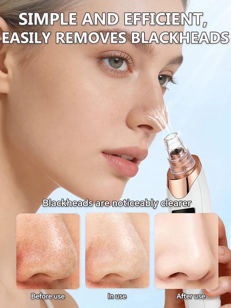 Appareil de nettoyage de peau facial pour l'élimination des points noirs et des boutons, aspirateur de pores pour un nettoyage en profondeur à domicile