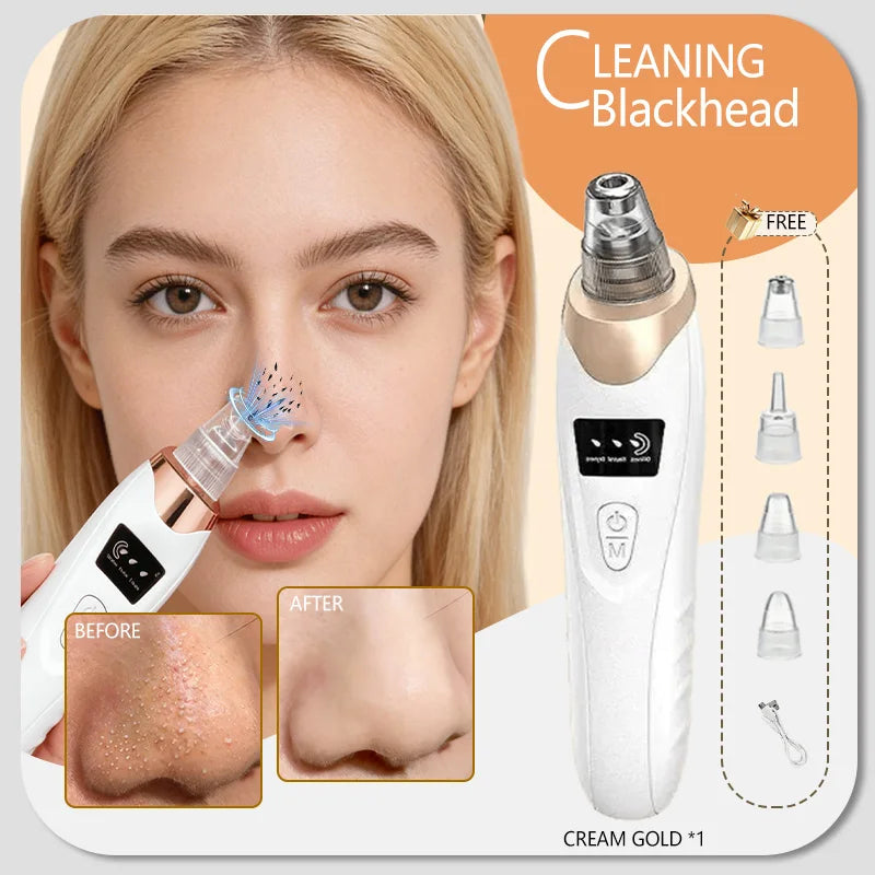 Appareil de nettoyage de peau facial pour l'élimination des points noirs et des boutons, aspirateur de pores pour un nettoyage en profondeur à domicile