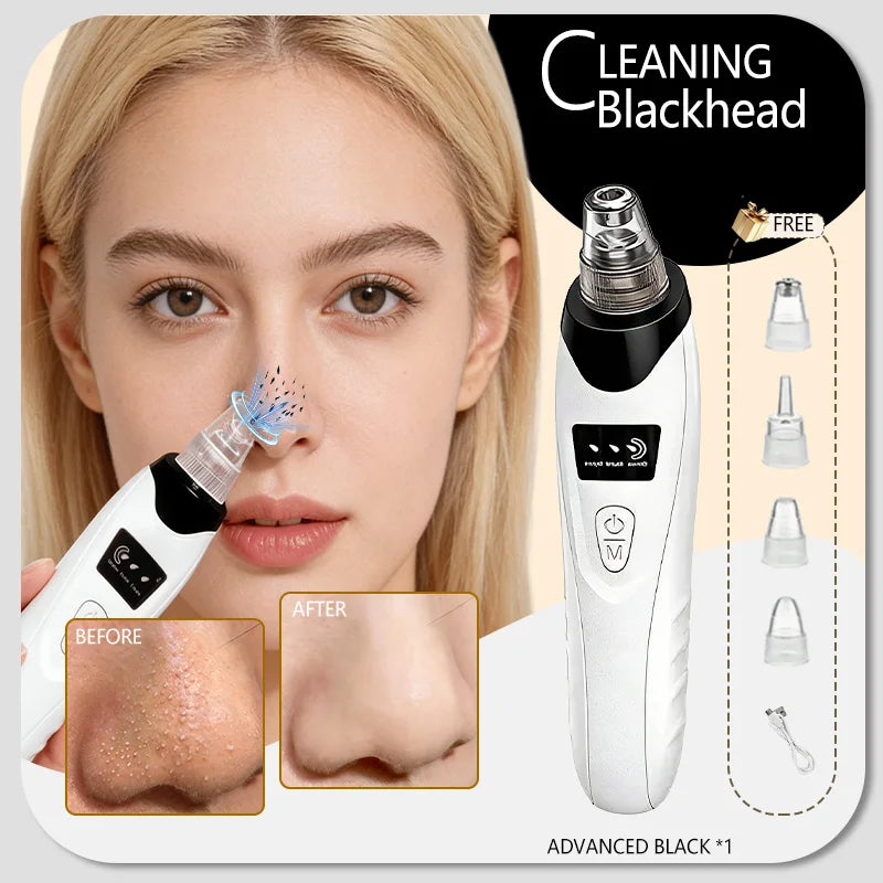 Appareil de nettoyage de peau facial pour l'élimination des points noirs et des boutons, aspirateur de pores pour un nettoyage en profondeur à domicile