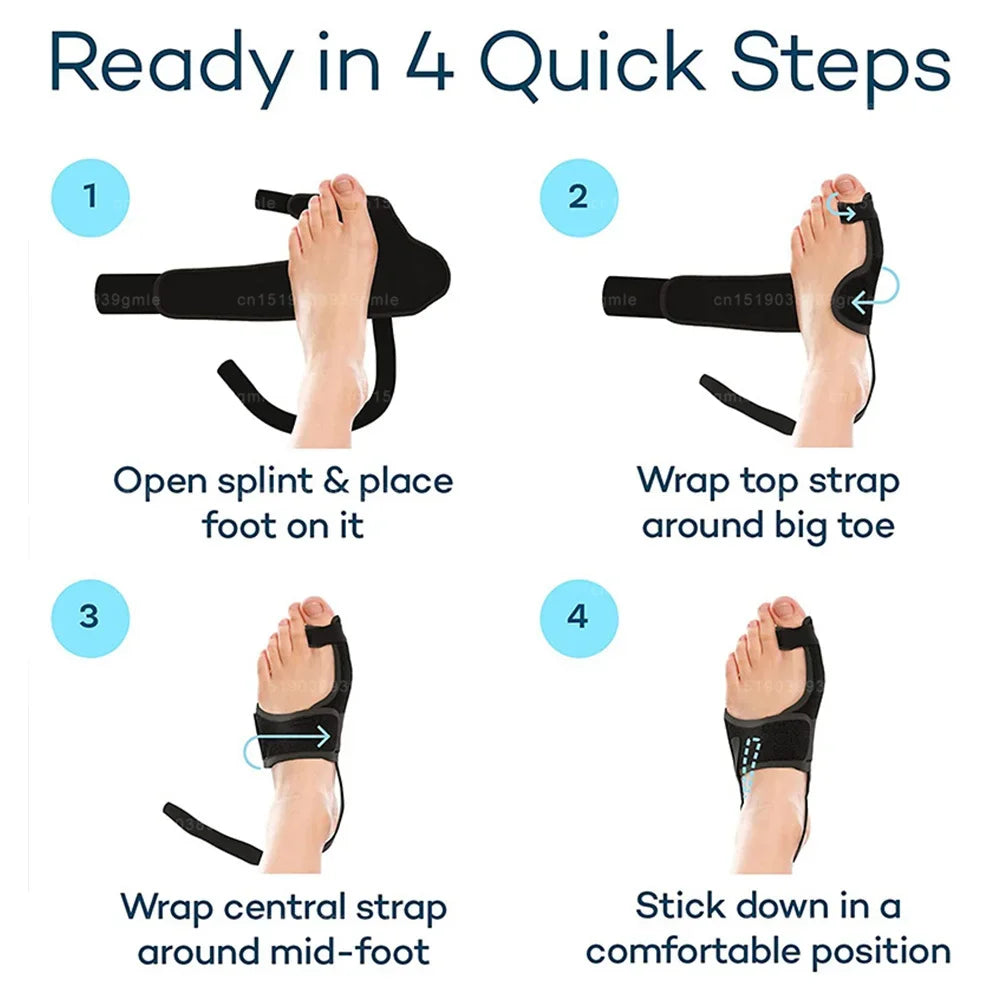Correcteur d'oignon attelle de nuit pour hallux valgus, redresseur d'orteils, correcteur orthopédique pour pédicure, protecteur d'oignon